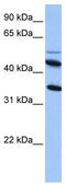 Interleukin 13 Receptor Subunit Alpha 2 antibody, TA336224, Origene, Western Blot image 