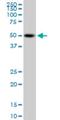 Proline-Serine-Threonine Phosphatase Interacting Protein 1 antibody, H00009051-M02, Novus Biologicals, Western Blot image 