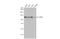 CYLD Lysine 63 Deubiquitinase antibody, GTX636663, GeneTex, Western Blot image 