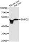 Sphingomyelin Phosphodiesterase 2 antibody, LS-C331311, Lifespan Biosciences, Western Blot image 