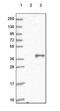 G Protein Subunit Alpha Q antibody, NBP2-54735, Novus Biologicals, Western Blot image 