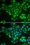 ATP Binding Cassette Subfamily A Member 3 antibody, STJ28942, St John