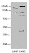 Transmembrane 9 Superfamily Member 1 antibody, LS-C676599, Lifespan Biosciences, Western Blot image 