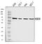 Histone-lysine N-methyltransferase NSD3 antibody, A32443-1, Boster Biological Technology, Western Blot image 