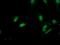 G1 To S Phase Transition 2 antibody, NBP2-00873, Novus Biologicals, Immunocytochemistry image 