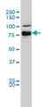 B-Raf Proto-Oncogene, Serine/Threonine Kinase antibody, LS-C196770, Lifespan Biosciences, Western Blot image 