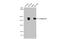 Collagen Type III Alpha 1 Chain antibody, GTX102997, GeneTex, Western Blot image 