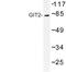 GIT ArfGAP 2 antibody, LS-C176810, Lifespan Biosciences, Western Blot image 