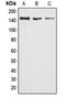 AT-Rich Interaction Domain 4B antibody, MBS820698, MyBioSource, Western Blot image 