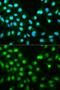 Protein Phosphatase 3 Catalytic Subunit Alpha antibody, GTX32485, GeneTex, Immunofluorescence image 