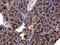 Cell Division Cycle 25A antibody, GTX102308, GeneTex, Immunohistochemistry paraffin image 