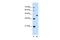 Gasdermin E antibody, PA5-42816, Invitrogen Antibodies, Western Blot image 