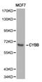 Cytochrome B-245 Beta Chain antibody, PA5-76034, Invitrogen Antibodies, Western Blot image 