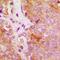 FES Proto-Oncogene, Tyrosine Kinase antibody, abx133470, Abbexa, Western Blot image 