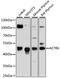 Actin Related Protein 6 antibody, LS-C748291, Lifespan Biosciences, Western Blot image 