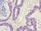 ZW10 Interacting Kinetochore Protein antibody, orb39554, Biorbyt, Immunohistochemistry paraffin image 