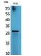 RNA Polymerase III Subunit G antibody, STJ96854, St John