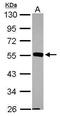 JNK1 + JNK2 antibody, PA5-28262, Invitrogen Antibodies, Western Blot image 