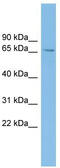 Solute Carrier Family 6 Member 1 antibody, TA334049, Origene, Western Blot image 