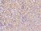 Mitochondrial Ribosomal Protein L45 antibody, 200958-T10, Sino Biological, Immunohistochemistry paraffin image 