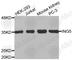 Inhibitor Of Growth Family Member 5 antibody, A2332, ABclonal Technology, Western Blot image 