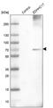 Palmitoyltransferase ZDHHC17 antibody, PA5-53492, Invitrogen Antibodies, Western Blot image 