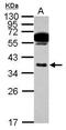 Chymase 1 antibody, PA5-28317, Invitrogen Antibodies, Western Blot image 