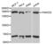 FA Complementation Group D2 antibody, abx001687, Abbexa, Western Blot image 