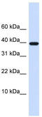 Chondromodulin antibody, TA335669, Origene, Western Blot image 