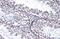 Androgen Receptor antibody, GTX100056, GeneTex, Immunohistochemistry paraffin image 