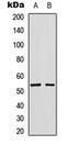 Glucagon-like peptide 1 receptor antibody, MBS8209463, MyBioSource, Western Blot image 