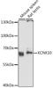 Potassium Two Pore Domain Channel Subfamily K Member 10 antibody, LS-C747071, Lifespan Biosciences, Western Blot image 