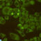 DEAD-Box Helicase 3 X-Linked antibody, LS-C812940, Lifespan Biosciences, Immunocytochemistry image 