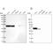 Reticulocalbin 1 antibody, PA5-58409, Invitrogen Antibodies, Western Blot image 