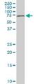 Histone Deacetylase 1 antibody, H00003065-M14, Novus Biologicals, Western Blot image 