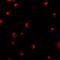 Karyopherin Subunit Alpha 1 antibody, NBP1-76297, Novus Biologicals, Immunofluorescence image 