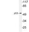p53 antibody, LS-C177389, Lifespan Biosciences, Western Blot image 