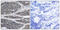 Nuclear Factor Kappa B Subunit 1 antibody, LS-C118190, Lifespan Biosciences, Immunohistochemistry paraffin image 