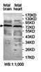 Katanin Regulatory Subunit B1 antibody, orb78111, Biorbyt, Western Blot image 