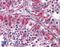Tumor Associated Calcium Signal Transducer 2 antibody, 46-736, ProSci, Western Blot image 