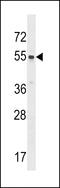 Src-Related Kinase Lacking C-Terminal Regulatory Tyrosine And N-Terminal Myristylation Sites antibody, 63-167, ProSci, Western Blot image 