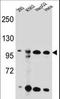Kinase suppressor of Ras 2 antibody, LS-C165650, Lifespan Biosciences, Western Blot image 