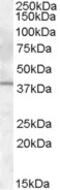 Interleukin 12B antibody, MBS421302, MyBioSource, Western Blot image 