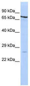 Proteasome Subunit Beta 4 antibody, TA342168, Origene, Western Blot image 