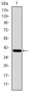 IL2 Inducible T Cell Kinase antibody, NBP2-37578, Novus Biologicals, Western Blot image 