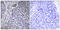 Heterogeneous Nuclear Ribonucleoprotein D Like antibody, LS-C199073, Lifespan Biosciences, Immunohistochemistry paraffin image 