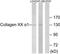 Collagen Type XX Alpha 1 Chain antibody, TA315679, Origene, Western Blot image 