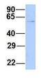 Chromatin Assembly Factor 1 Subunit B antibody, GTX44690, GeneTex, Western Blot image 