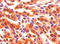 Fatty Acid Binding Protein 3 antibody, LS-C212333, Lifespan Biosciences, Immunohistochemistry paraffin image 