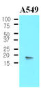 Protein Phosphatase 1 Regulatory Inhibitor Subunit 14A antibody, LS-C93787, Lifespan Biosciences, Western Blot image 